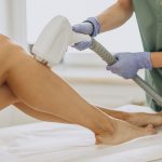 laser-hair-removal-2_opt