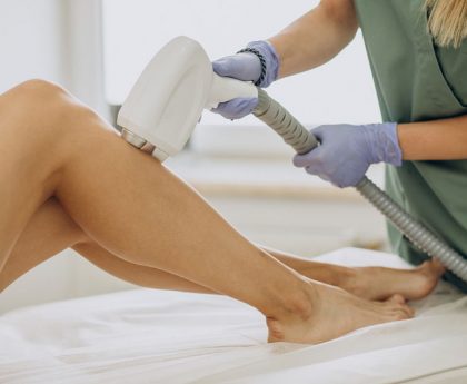 laser-hair-removal-2_opt